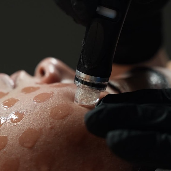 Hydra Nati Facial