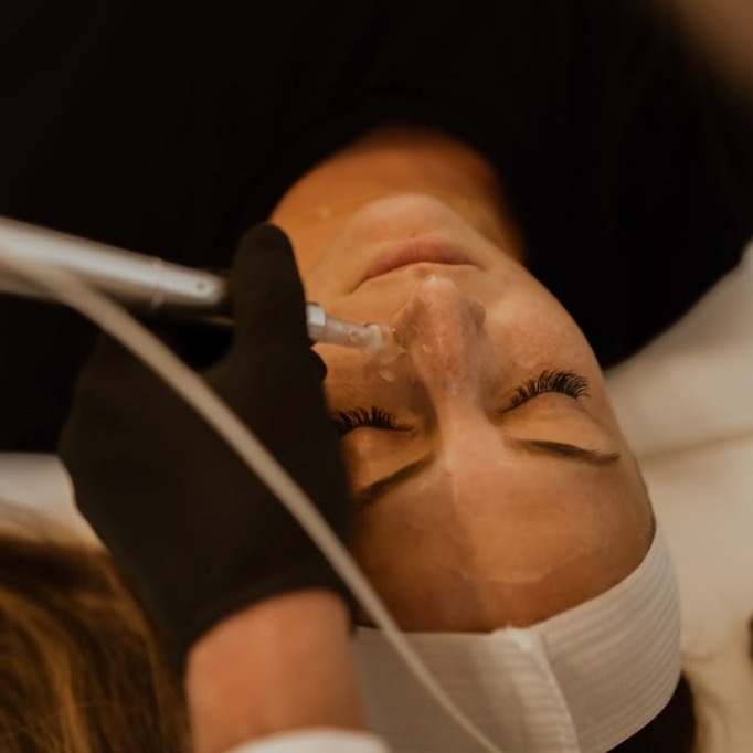 Microneedling Professionnel Kit